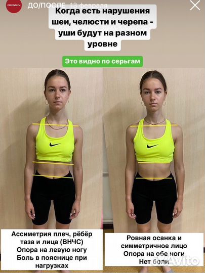 Кинезиолог. Лфк. Массаж. Остеопат. Омск