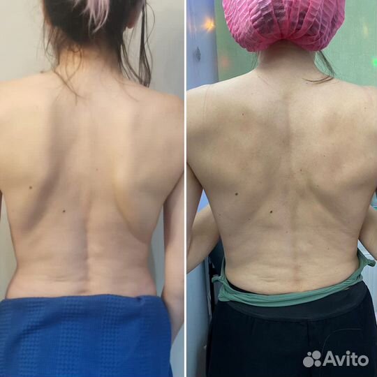 Аппаратная коррекция фигуры