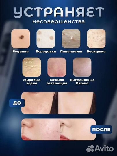 Аппарат для удаления дефектов кожи, новые