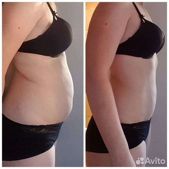 Аппаратный массаж тела и лица