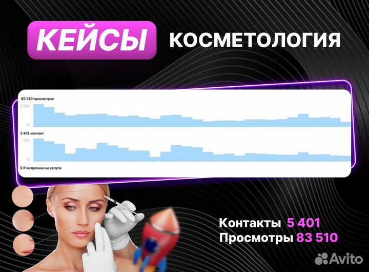 Авитолог / Услуги Авитолога/ Магазин