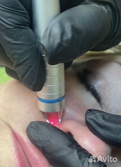 Диодный лазер