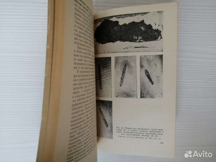 Судебно-медицинская диагностика пола / А. Капустин