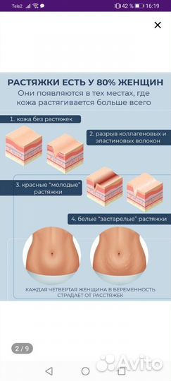 Тканивая маска для живота от растяжек