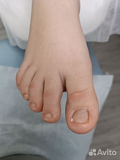 Подологический педикюр