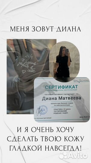 Электроэпиляция модель