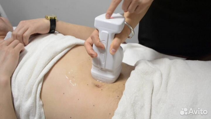 Липосоникс, лазерный липолиз