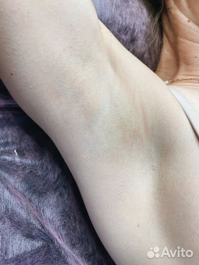 Лазерная эпиляция \ диодный лазер \ удаление волос