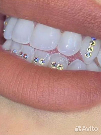 Установка Скайсов