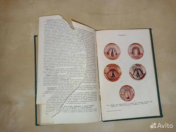 Болезни уха, горла и носа. Темкин. 1939
