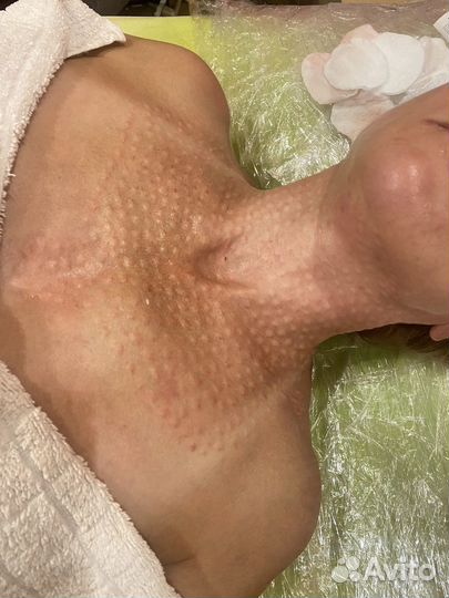 Косметология массаж лица