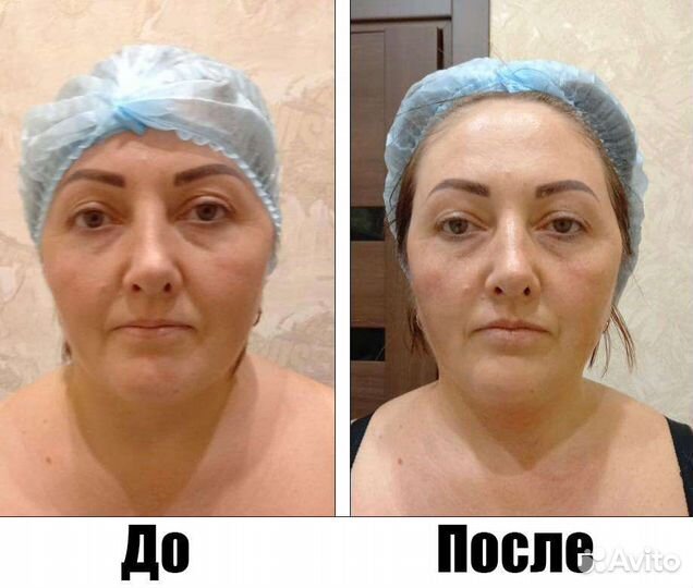 Аппаратная терапия 