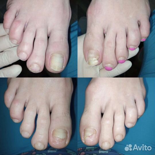 Подолог с медицинским образованием Девяткино