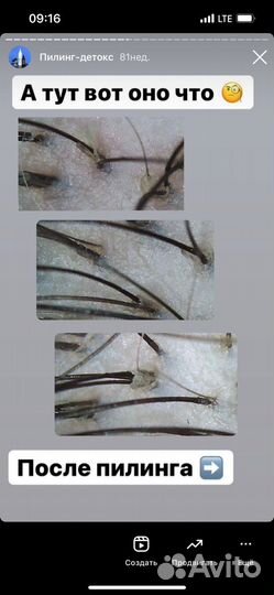 Кератиновое выпрямление волос