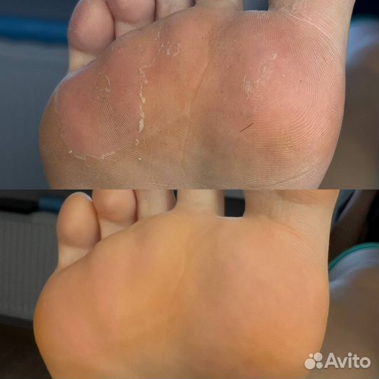 Маникюр и педикюр