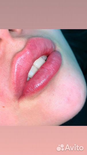 Требуются модели на всю контурную пластику