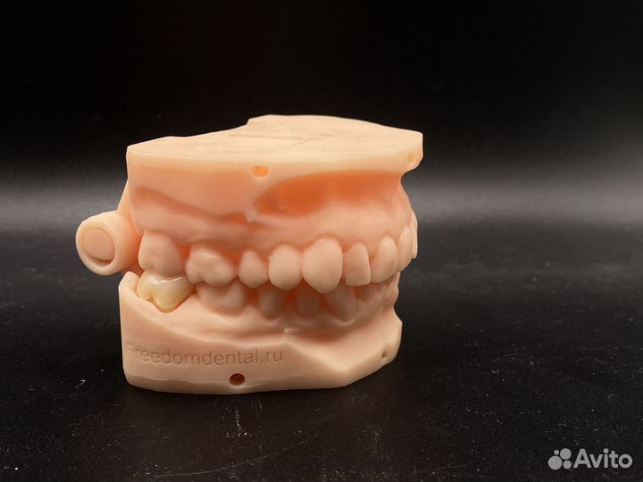 Коронка циркониевая/ e-max наготово по интраоральн