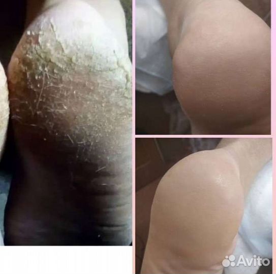 Педикюр мужской