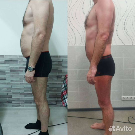 LPG массаж/Обертывание