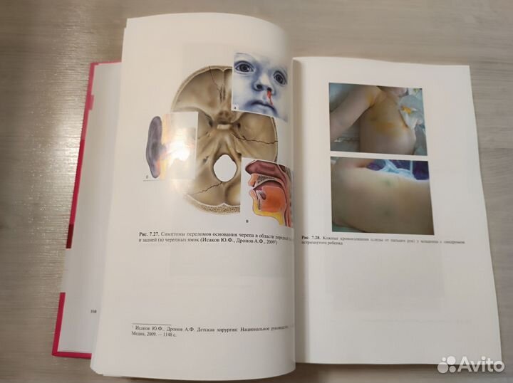 Детская хирургия. Учебник. Разин, Минаев, Турабов