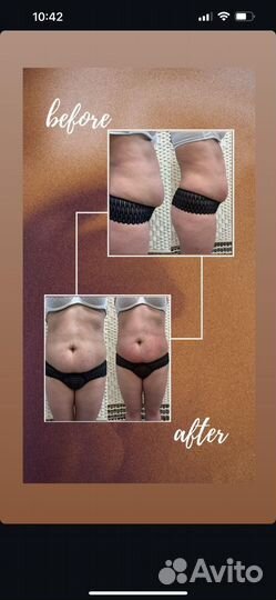 Аппаратный массаж, вибро, горячий вакуум, LPG