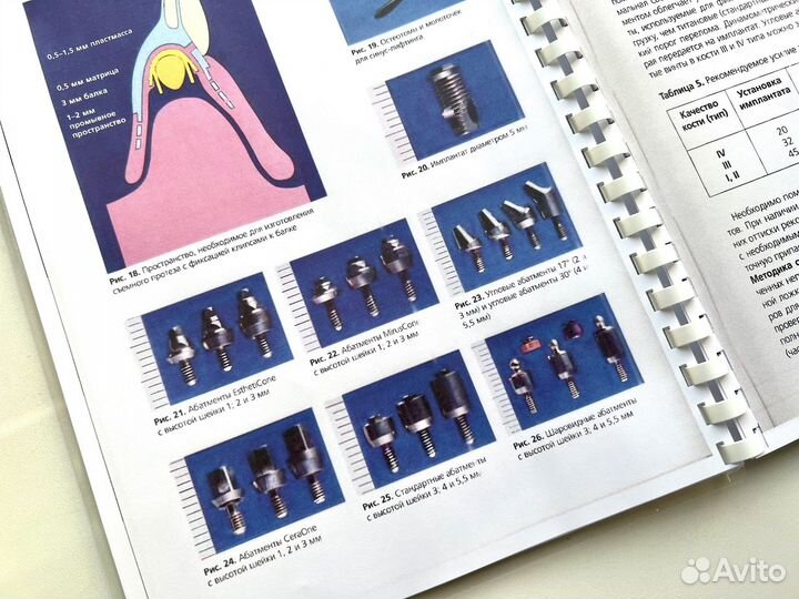 Стоматологическая реабилитация