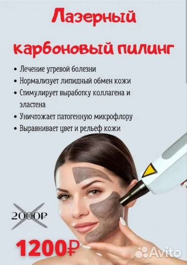 Карбокситерапия