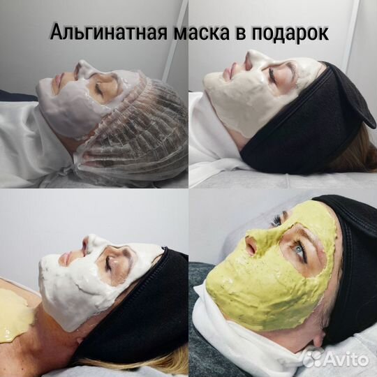 Карбоновый пилинг