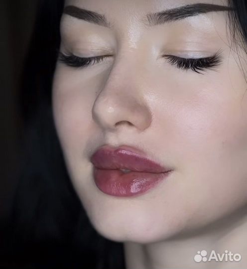 Увеличение губ, ботокс, био, мезо, липолитик