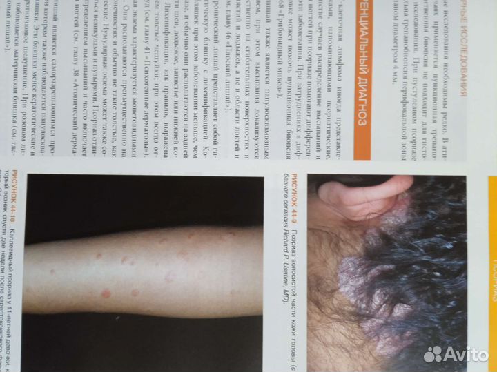 Дерматология. Атлас справочник практик врача