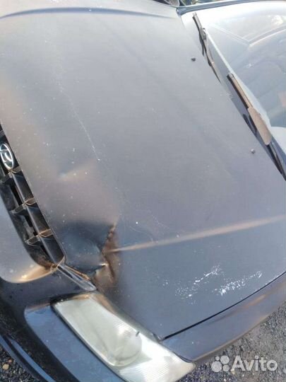 Hyundai Accent 1.6 МТ, 2004, 241 449 км