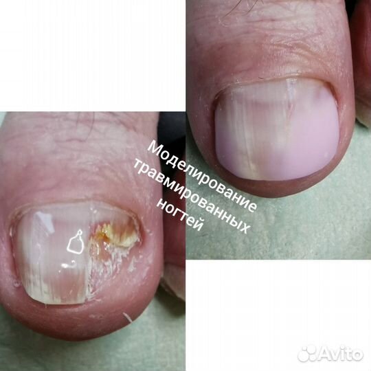 Маникюр педикюр наращивание шугаринг