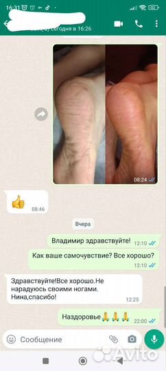 Чистые пяточки