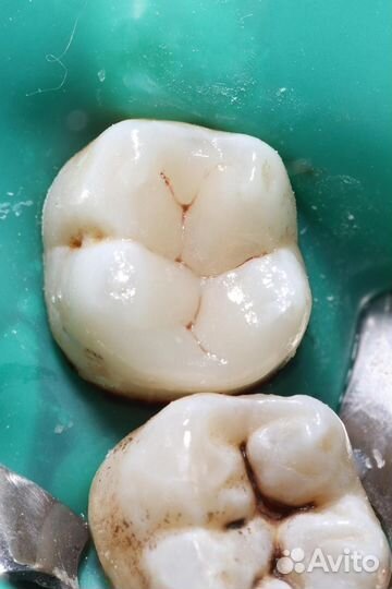 Врач стоматолог терапевт(универсал)