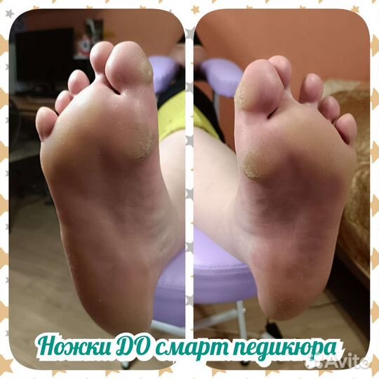 Педикюр в Ступино