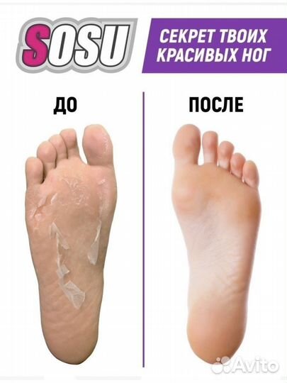 Педикюрные носочки sosu