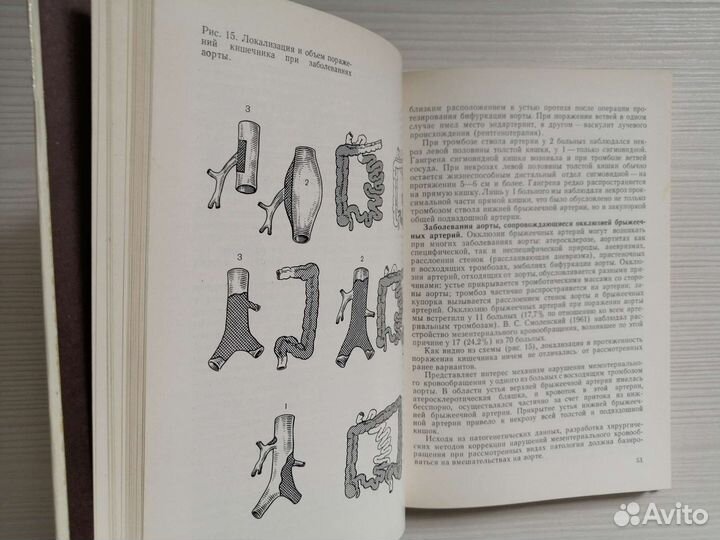 Острые нарушения мезентериального кровообращения