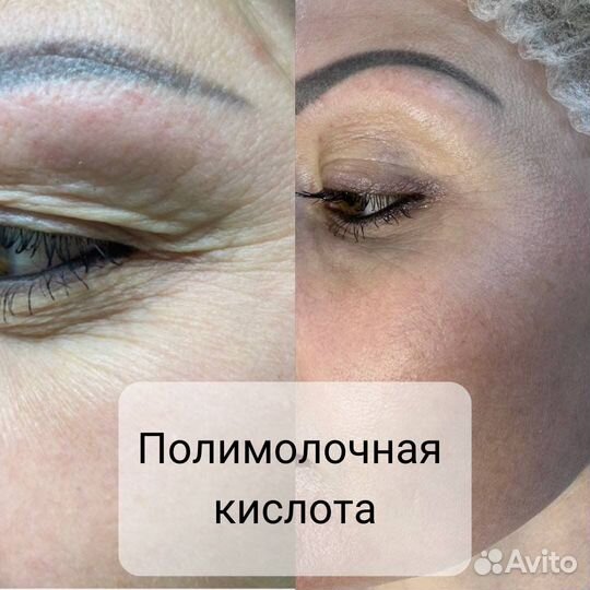Косметолог Волгодонск