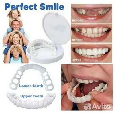 Съёмные зубы, Виниры для зубов