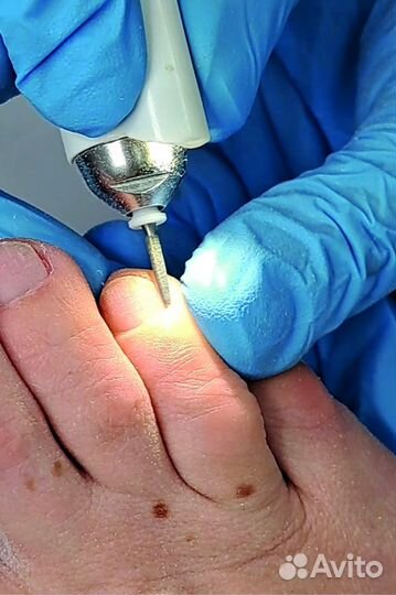 Профессиональный Подопедикюр в Калининграде