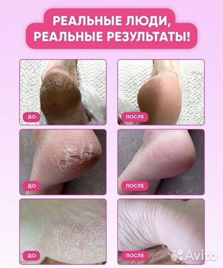 Гель для пяток и пемза в подарок