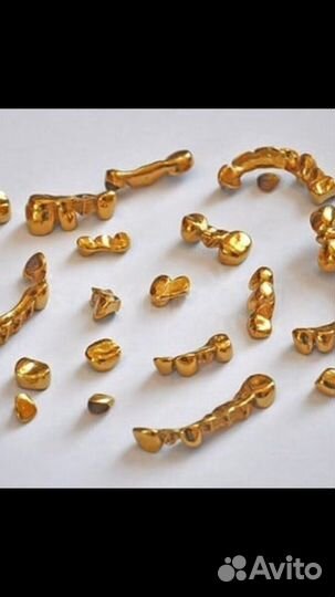 Золотые коронки