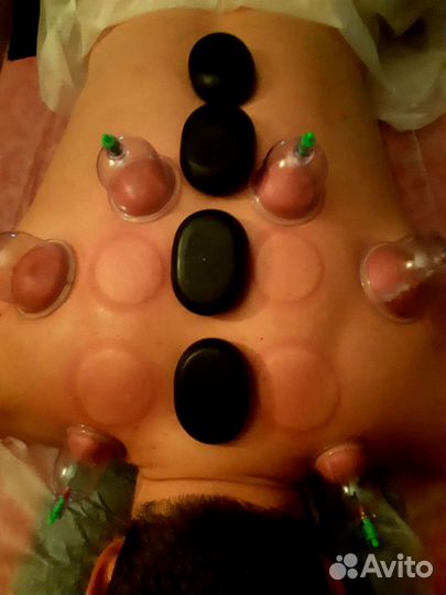 Массаж Планерная