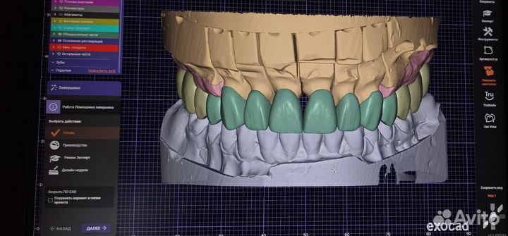 Зубной техник.Cad/cam.Зубные протезы