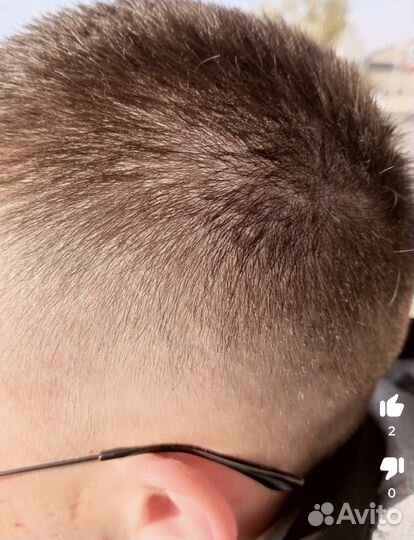 Бальза Против : Себорее/Перхоти/Розацеи