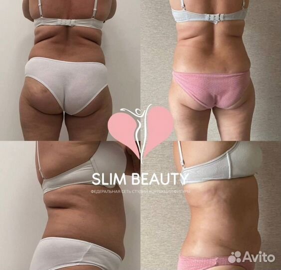 Похудение до 10 кг за курс