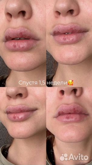 Услуги косметолога