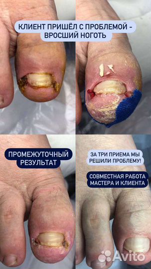 Услуги подолога