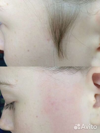 Шугаринг мужской женский