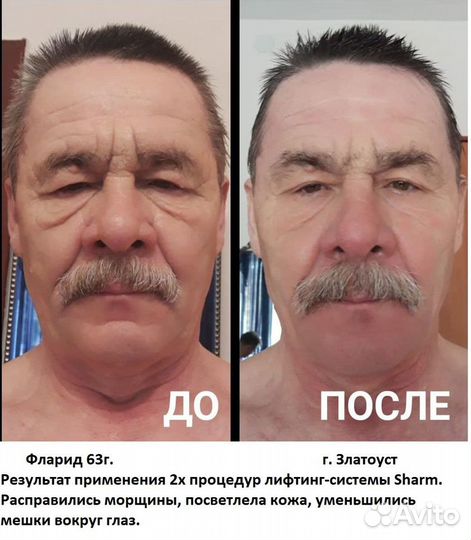 Косметика Hazna для тонуса мышц лица